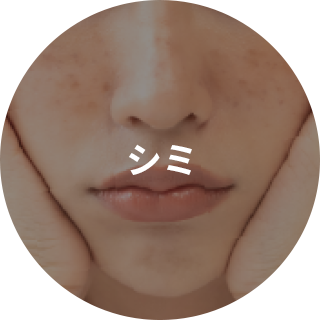 シミ